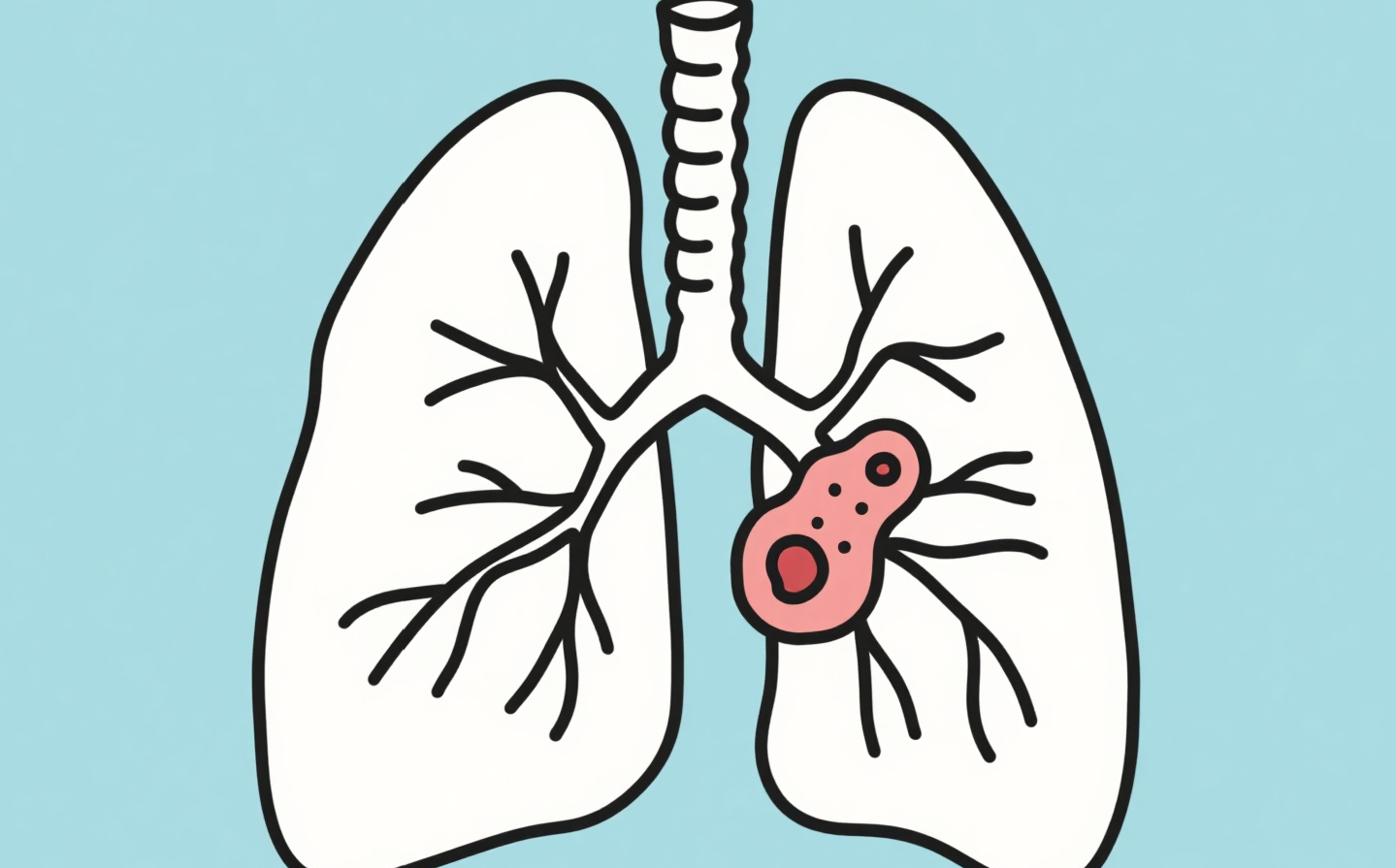 成都治癌症的老中医