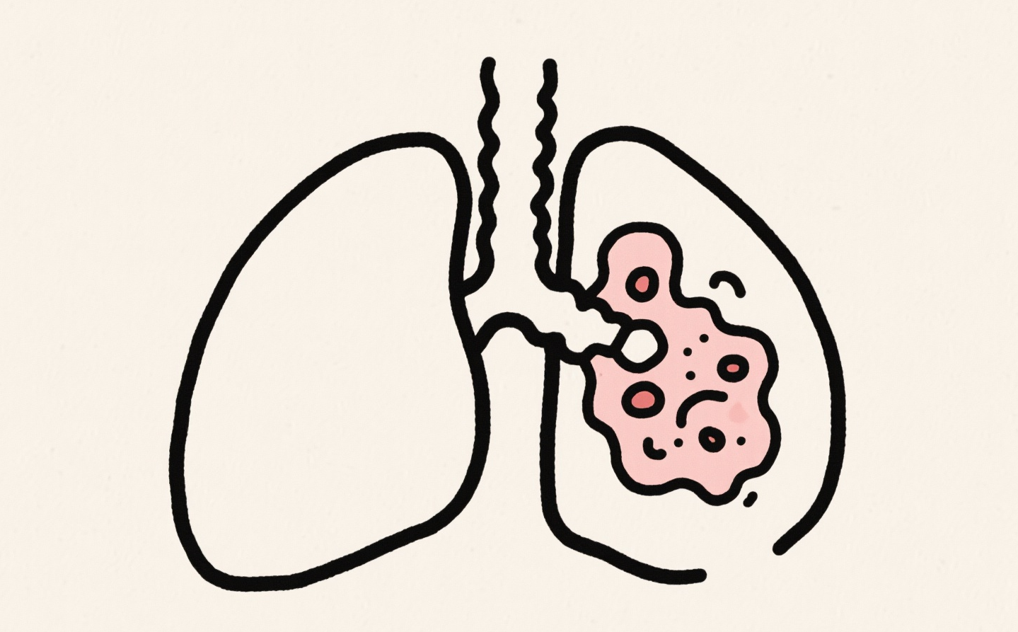 成都治癌症的老中医